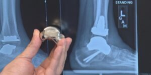 The Medical Device Companies Building on Evidence, Not Just Innovation